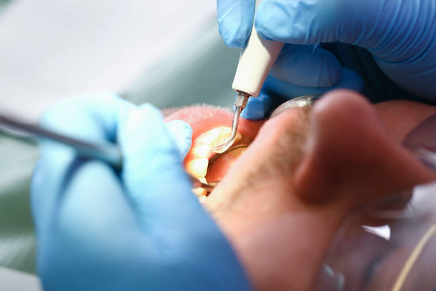 Best Emergency Dental Surgery in Warr Acres, OK